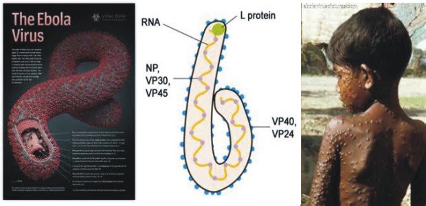 The Ebola virus was first identified in 1976.